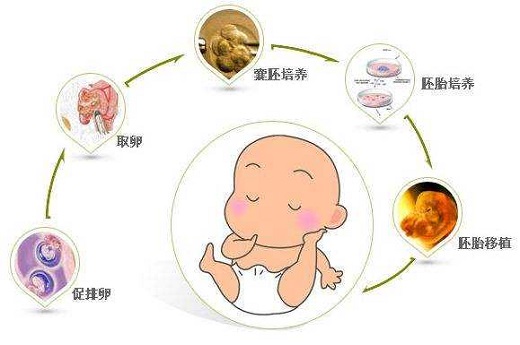 成都试管婴儿哪家最好？试管婴儿有配错的吗？