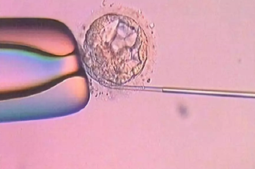 体外受精和试管婴儿的区别