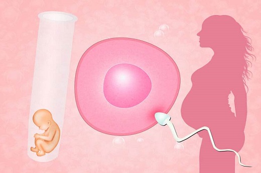 成都 试管婴儿医院-多囊卵巢综合征可以做试管婴儿吗？