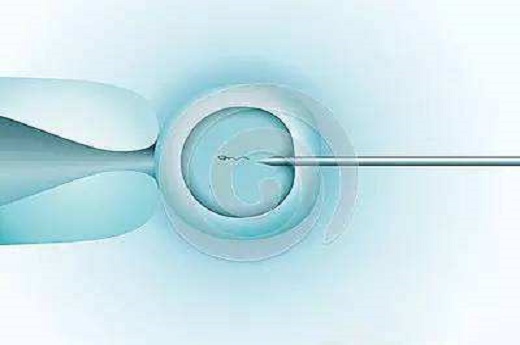 成都哪里做试管婴儿成功率高-试管婴儿双胎风险大吗？